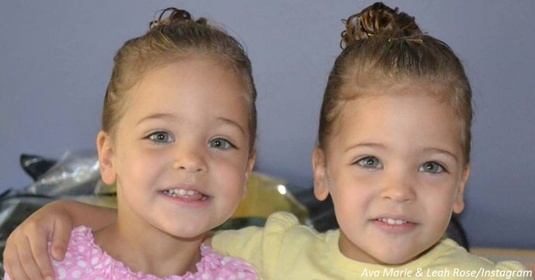 У 7 років їх назвали найкрасивішими близнюками в світі. Ось як вони виглядають зараз