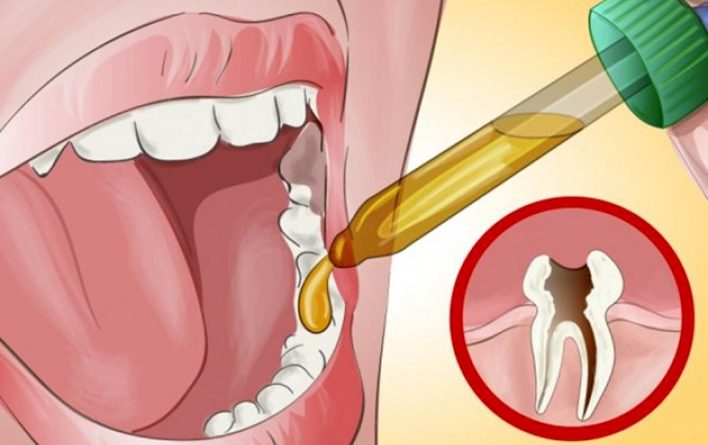 Як швидко позбутися від тяжкого зубного болю коли у вас немає можливості потрапити до стоматолога? Біль зникає за 1 секунду!