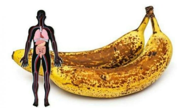 Ось, що станеться, якщо ви протягом місяця будете щодня з’їдати по два банана з темними плямами
