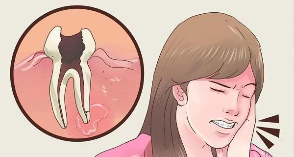 Корисно знати! Ось, як зняти будь-який зубний біль усього за кілька секунд!